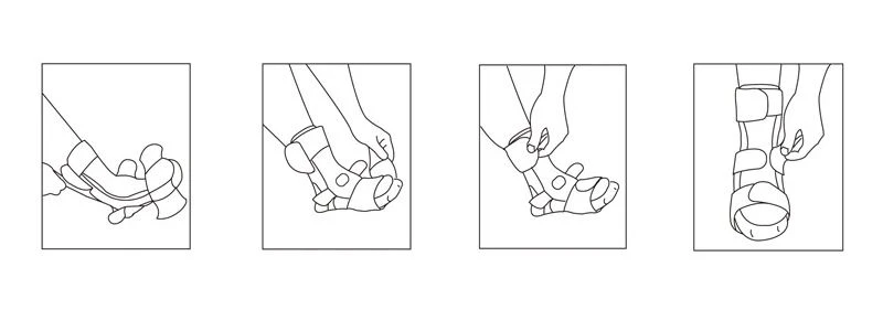 Instructions for Use the Foot splint